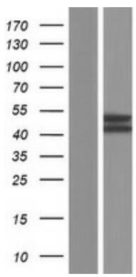 Western blot validation of overexpression lysate using anti-DDK antibody. Left: Cell lysates from untransfected HEK293T cells; Right: Cell lysates from HEK293T cells transfected with MRS2 plasmid.